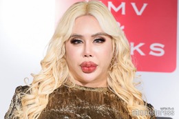 アレン様、整形前の18歳ギャル男時代の写真公開 スタジオ衝撃「モテたでしょ？」