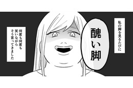 「醜い脚」母は私の脚を見る度、笑いながら嫌味を繰り返【毒親に育てられました２ #18】