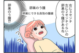 「卵巣のう種がある⁉」「帝王切開の傷が開いてる!?」しかも、副作用で更年期症状が？【100人の更年期 #49】