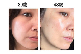 頭や首、肩のコリも老け肌につながっていた。肌年齢マイナス14歳美容のプロがやめたこととは？