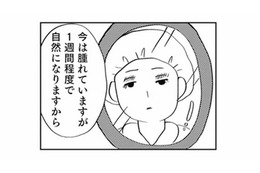 「整形しないと幸せになれない」中学卒業後、母の勧めで二重整形をすることに【親に整形させられた私が母になる #１】