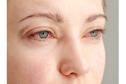 「目のかゆみ」がつらすぎる…その花粉症、実は“肝の疲れ”かも？漢方の専門家がおすすめする「酸味」と「苦味」の食べ物