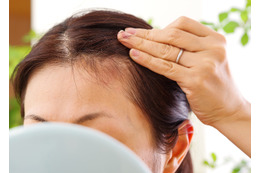 「抜け毛」が増えるのは、季節の変わり目のせい？ストレスのせい？「育毛鍼灸師が教える「異常信号」と、髪を生やすためにできること