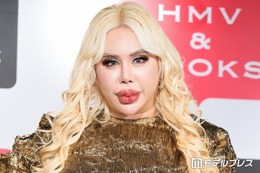“整形総額1億円超え”アレン様、月の美容費は「140〜150万円」唇ヒアルロン酸注射事情もぶっちゃけ「針穴から漏れ出るくらい…」 画像