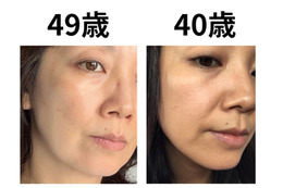 40代で肌年齢−14歳！ 美容医療なしで「40歳より透明感が出た」49歳美容ライターがリピ買いする美容成分TOP2