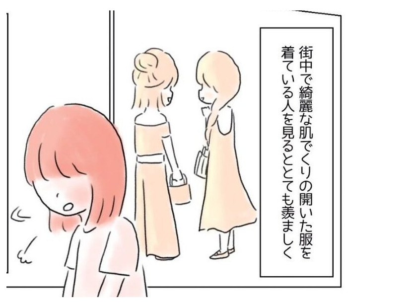 背中に大きなアザがある女性。勇気を出して“背中の開いたドレス”と着ると…→男性が声をかけてきて！？