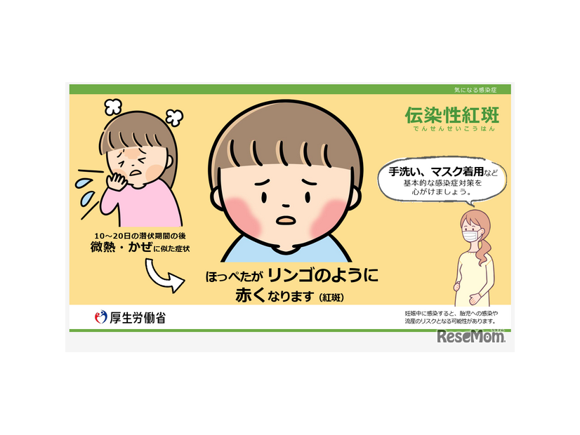 厚生労働省、伝染性紅斑（リンゴ病）に注意喚起