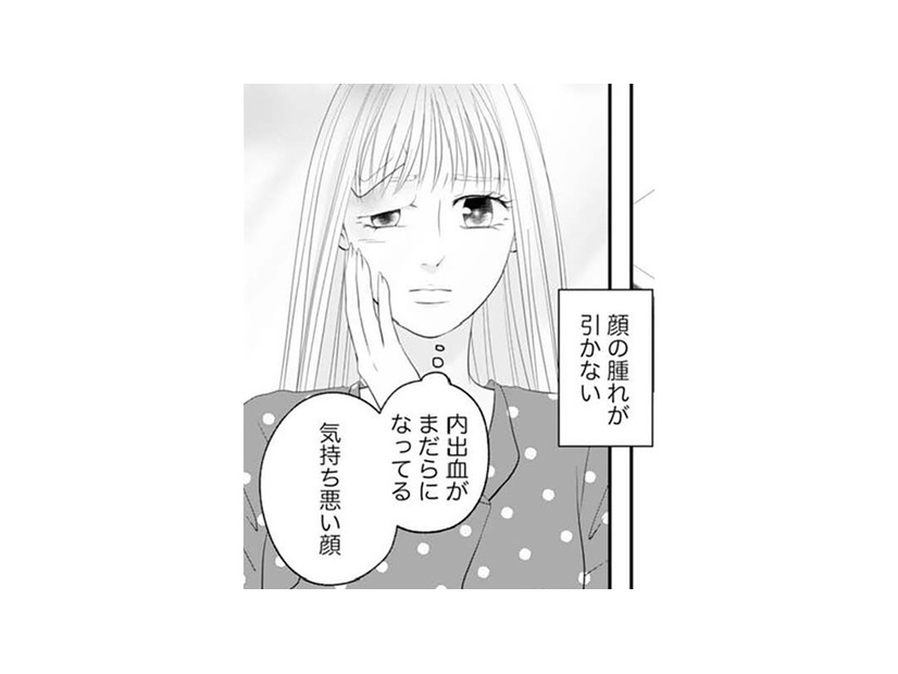 顔だけが取り柄の私なのに腫れが引かない。これからどうすればいいの？【かつて女の子だった人たちへ #32】