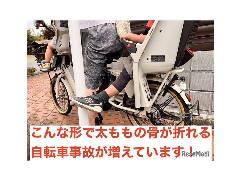 こんな形で太ももの骨が折れる事故が増えています