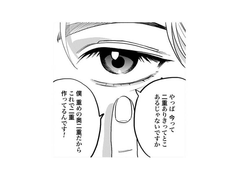 今は二重ありきの時代。アイテープ代わりの意外なものとは？【Dressing　美容外科医　森野まりあ #17】