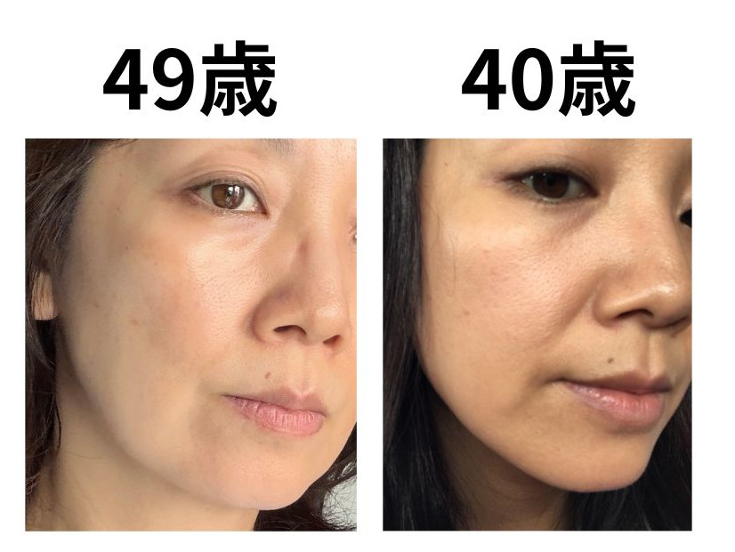 40代で肌年齢−14歳！ 美容医療なしで「40歳より透明感が出た」49歳美容ライターがリピ買いする美容成分TOP2