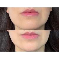 40・50代が老けて見えるのはリップの色のせい？オバ見えリップの特徴【2025年度ベスト記事セレクション】