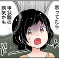 「更年期」の症状と決めつけないで！ 潜んでいたのは甲状腺の病気かもしれない⁉【100人の更年期 #29】
