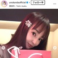 神田うの、薄毛治療を公表 施術の様子公開「オデコ（前髪）だけが薄い問題」 画像