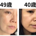 40代で肌年齢−14歳！ 美容医療なしで「40歳より透明感が出た」49歳美容ライターがリピ買いする美容成分TOP2 画像