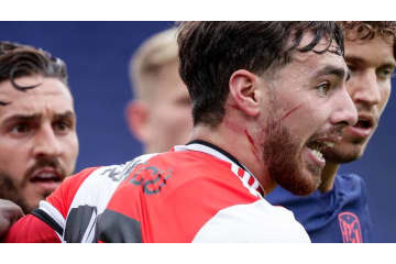 アトレティコ戦で出血の乱闘勃発！シメオネもフェイエ監督を突き飛ばす 画像