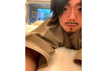 カマたく、人中短縮＆眉下切開の整形報告 ダウンタイム中の自撮りも公開「マジこいつ誰？」「顔が腫れてめちゃくちゃおもろい」 画像