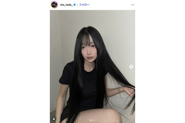 「月曜から夜ふかし」多田さん、二の腕脂肪吸引ビフォーアフターに反響「変化がすごい」「参考になる」 画像