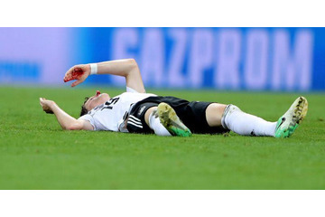 W杯で鼻負傷のドイツ代表ルディ、手術を受ける 画像