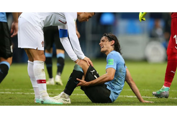 カバーニ、W杯準々決勝はどうなる…ウルグアイ代表が怪我について発表 画像