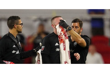 血だらけのルーニー、アメリカで初ゴール＆初怪我 画像