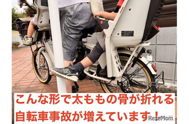こんな形で太ももの骨が折れる事故が増えています