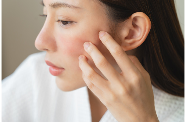 花粉の肌荒れを加速する、NGお手入れとは。40代50代は侮っていると長期化する恐れも……！
