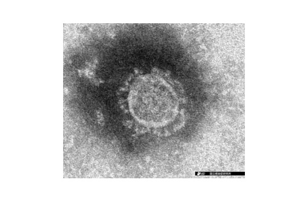 新型コロナウイルスの電子顕微鏡写真（国立感染症研究所提供）