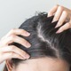 40代が猛暑でベタついた頭皮を放置すると「オバ見え」一直線！？「もしかして加齢臭？」ニオイやかゆみ、抜け毛など更年期世代の頭皮トラブルが招く「避けたい事態」と原因、対処法とは？