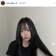 「月曜から夜ふかし」多田さん「残り10日で術後1ヶ月です」ノーマルカメラで整形DTの経過報告「強さに感動」「早く良くなりますように」と反響
