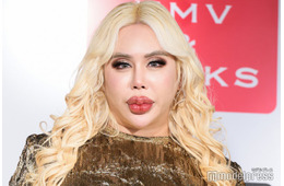 アレン様、整形前の18歳ギャル男時代の写真公開 スタジオ衝撃「モテたでしょ？」
