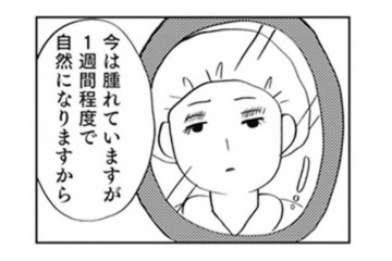 「整形しないと幸せになれない」中学卒業後、母の勧めで二重整形をすることに【親に整形させられた私が母になる #１】 画像