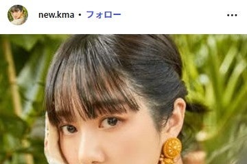 元人気韓国アイドル、美容施術での顔面火傷を告白 腫れ上がった術後の頬公開「正気でいられると思う？」 画像