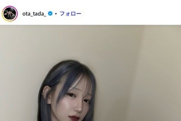 「月曜から夜ふかし」多田さん「上顎と下顎の拘縮はまだまだmax」整形手術のダウンタイム9日目の姿公開「腫れが引いてる」「痛みに負けずに頑張って」と反響 画像
