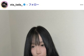 「月曜から夜ふかし」多田さん、両顎＆輪郭手術の術後2ヶ月ビフォーアフター公開「小顔になってる」「リアルで参考になる」と反響 画像